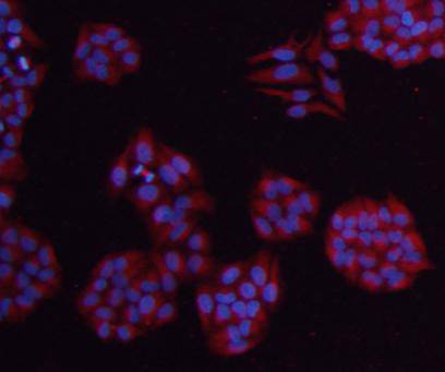 β-tubulin Antibody