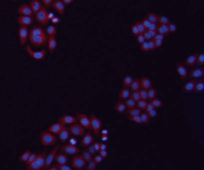 β-tubulin Antibody