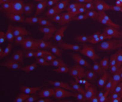 β-tubulin Antibody