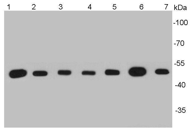 β-tubulin Antibody