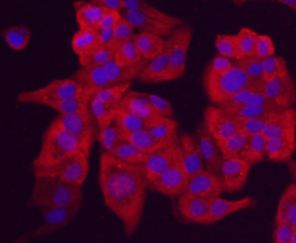 Chromogranin-A(C-term) Antibody