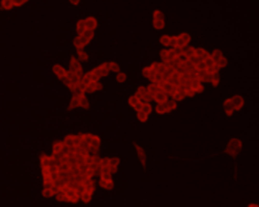 Chromogranin-A(C-term) Antibody