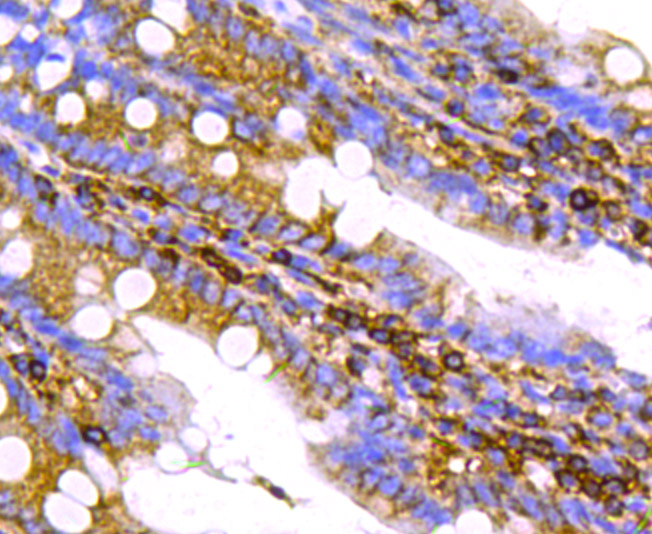 Chromogranin-A(C-term) Antibody