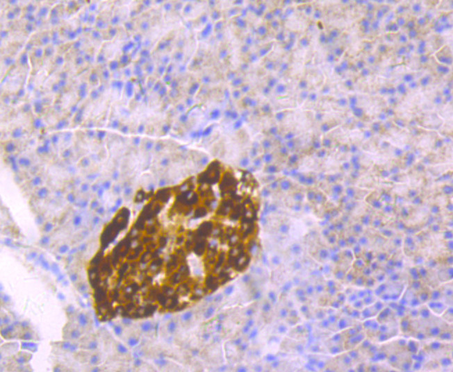 Chromogranin-A(C-term) Antibody