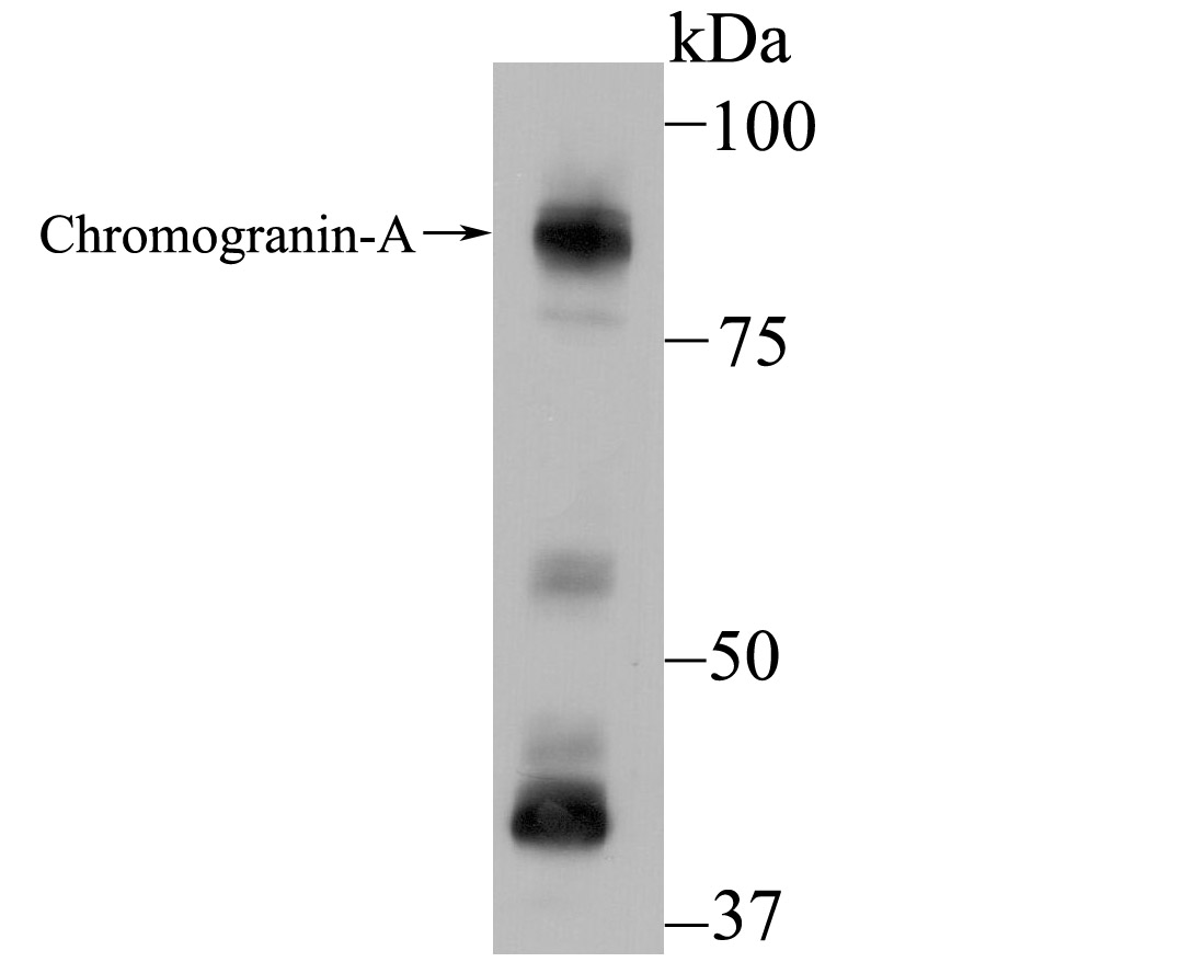 Chromogranin-A(C-term) Antibody