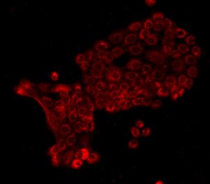 E-Cadherin Antibody