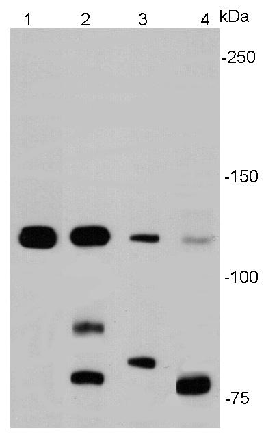 E-Cadherin Antibody