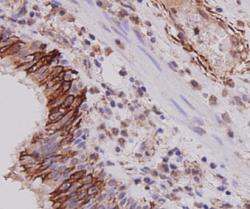 Cytokeratin-7 Antibody