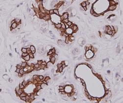 Cytokeratin-7 Antibody