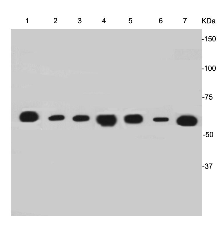 Cytokeratin-7 Antibody