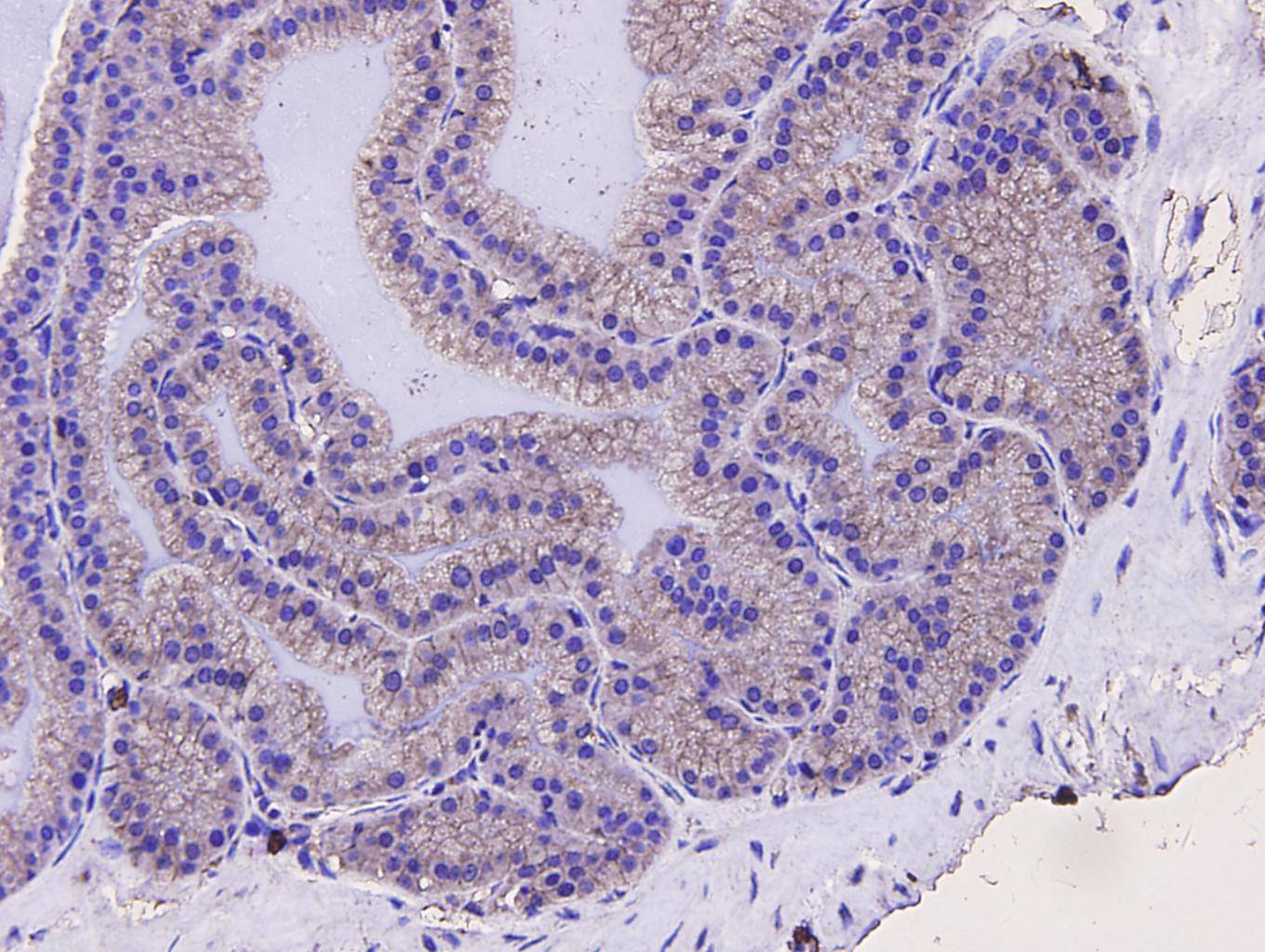 Sequestosome-1 Antibody