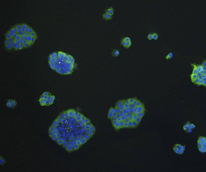 EP-CAM Antibody