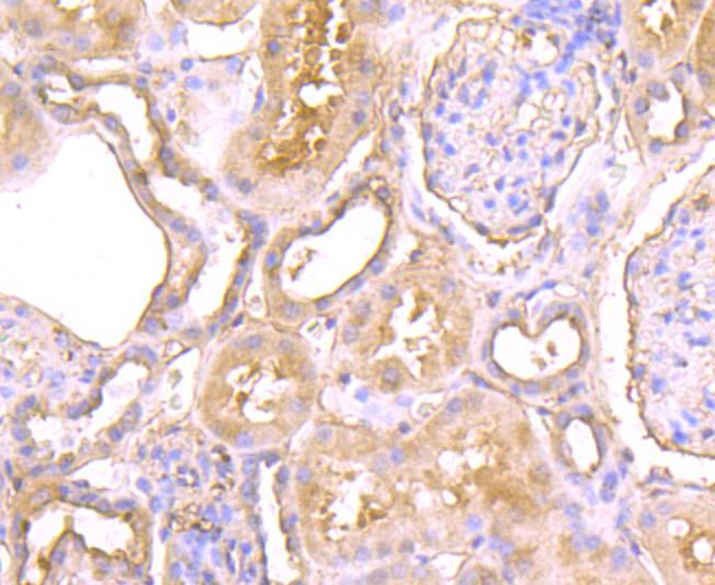 CTHRC1 Antibody