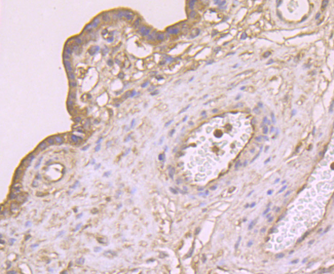 CTHRC1 Antibody