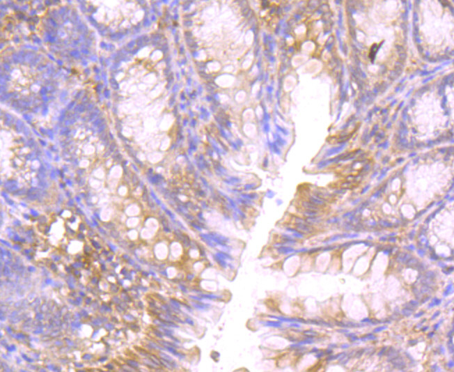 CTHRC1 Antibody