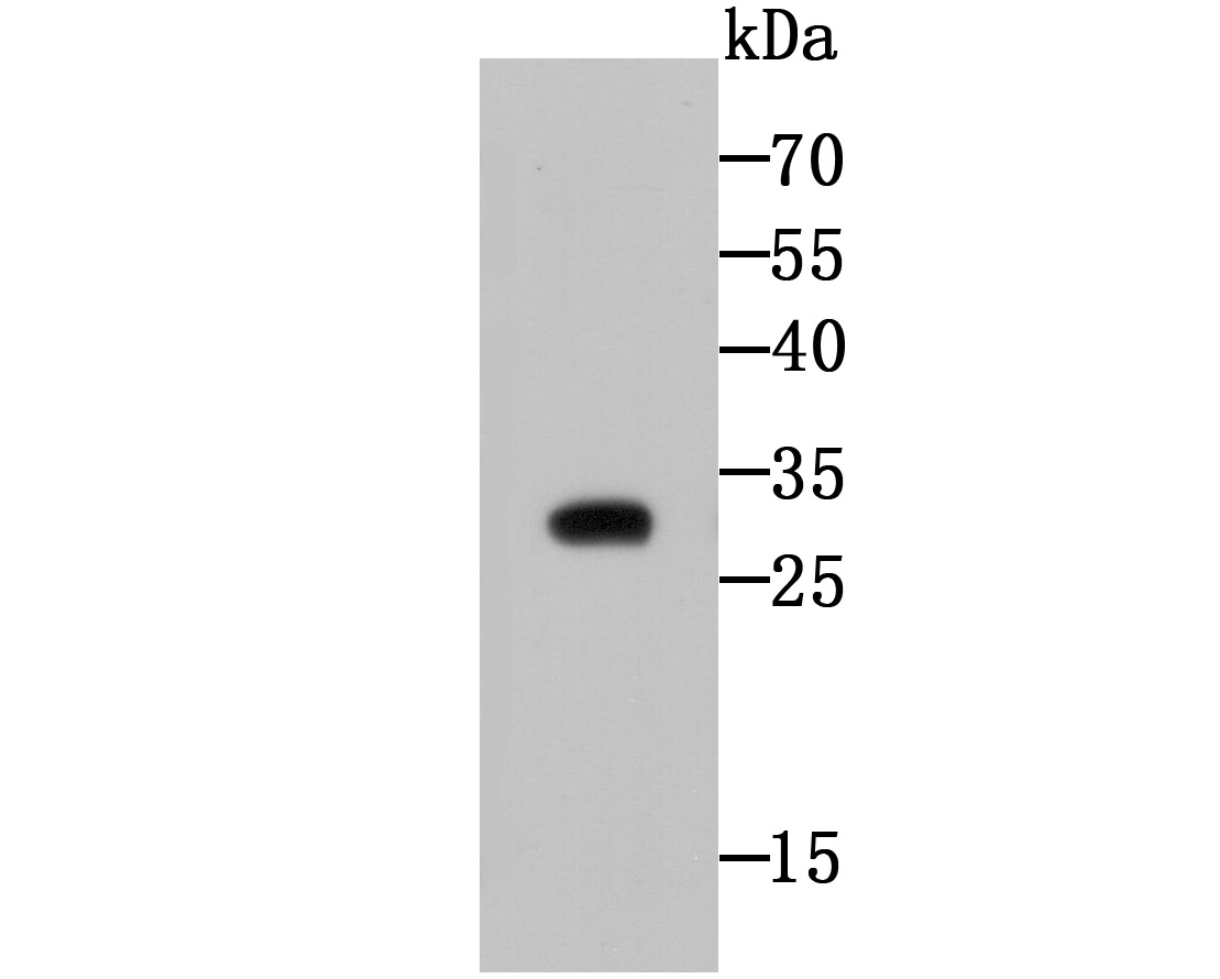 CTHRC1 Antibody