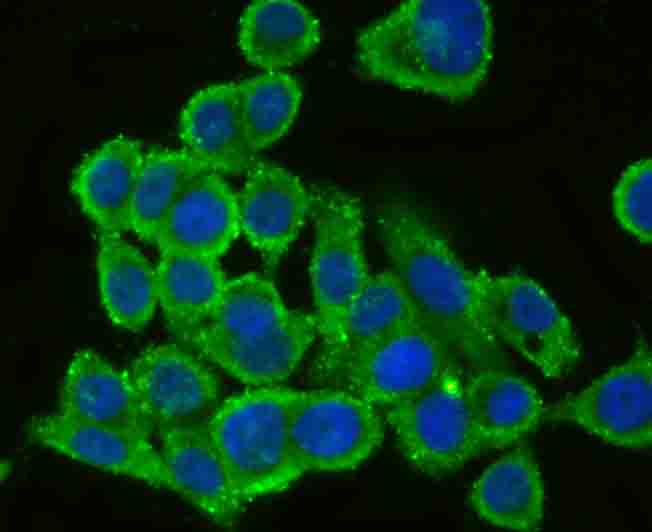 CD130 Antibody