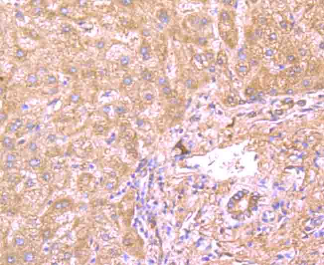 CD130 Antibody