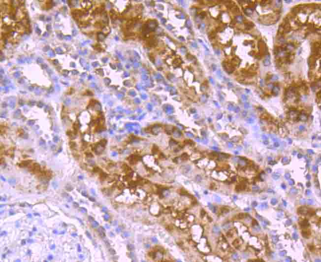 CD130 Antibody