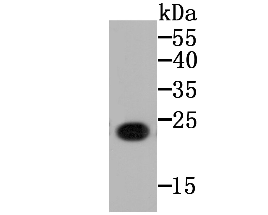 CD130 Antibody