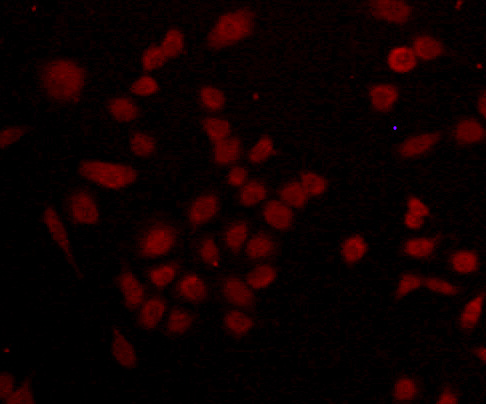 CUB domain-containing protein 1 Antibody