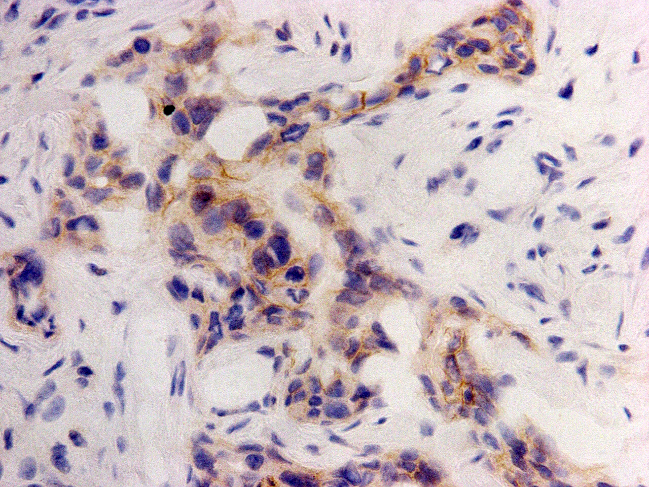 CUB domain-containing protein 1 Antibody