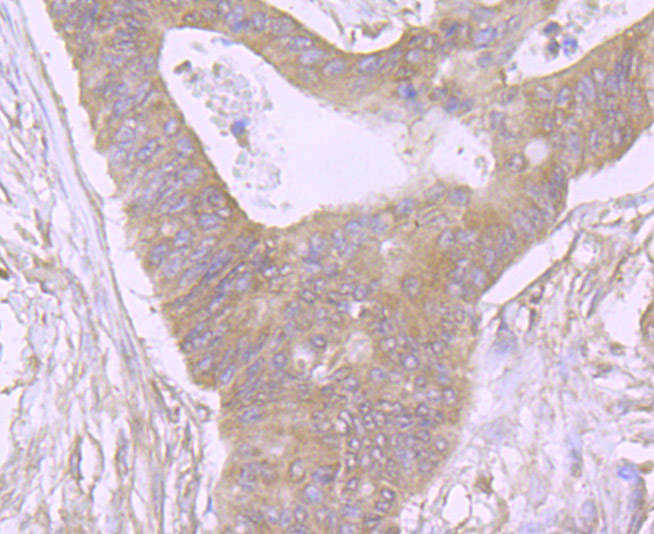 CUB domain-containing protein 1 Antibody