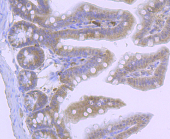 CUB domain-containing protein 1 Antibody