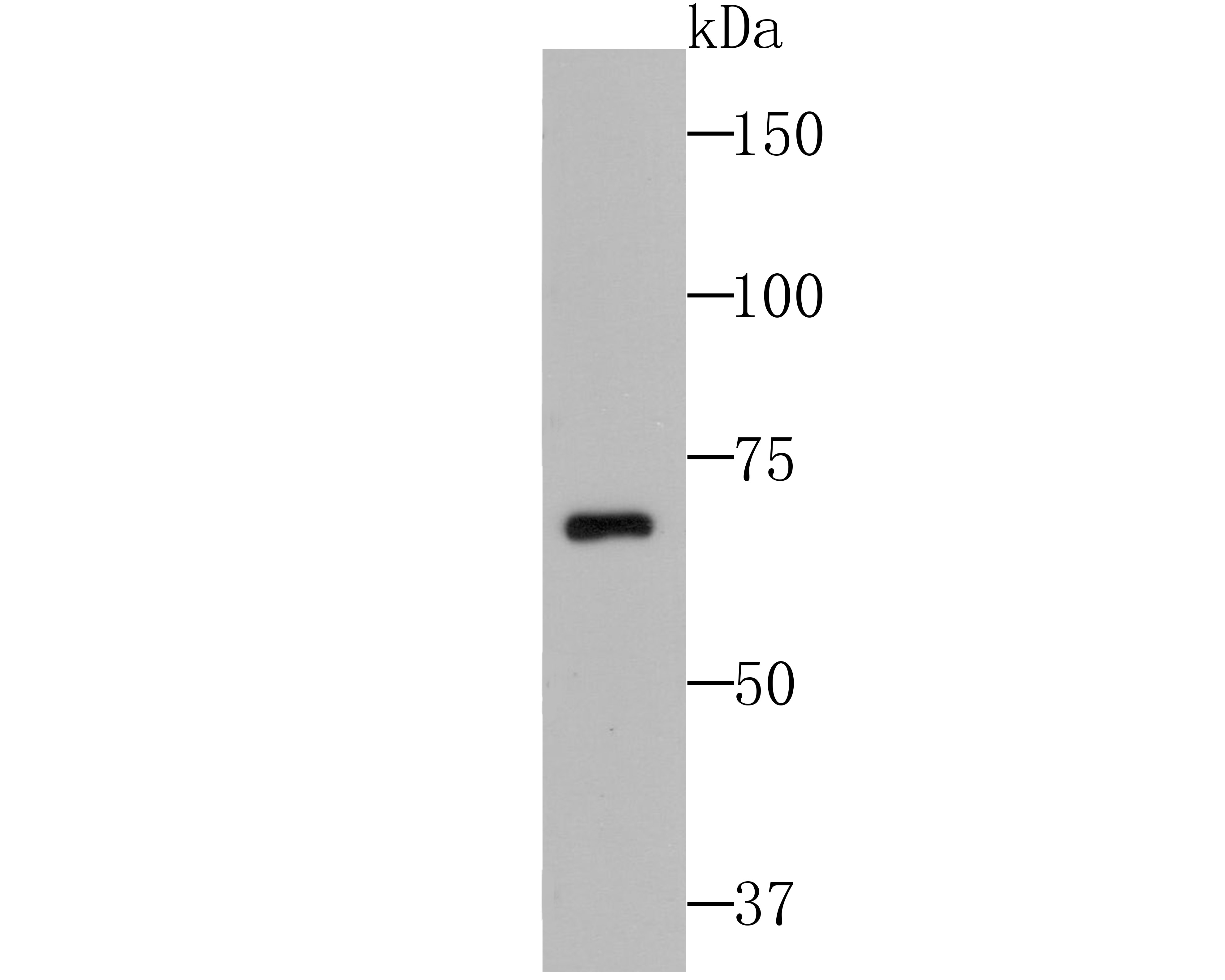 CUB domain-containing protein 1 Antibody