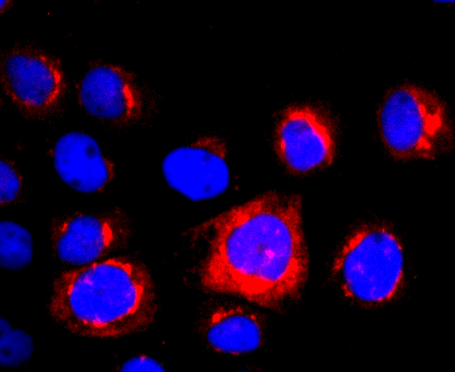 NGAL Antibody