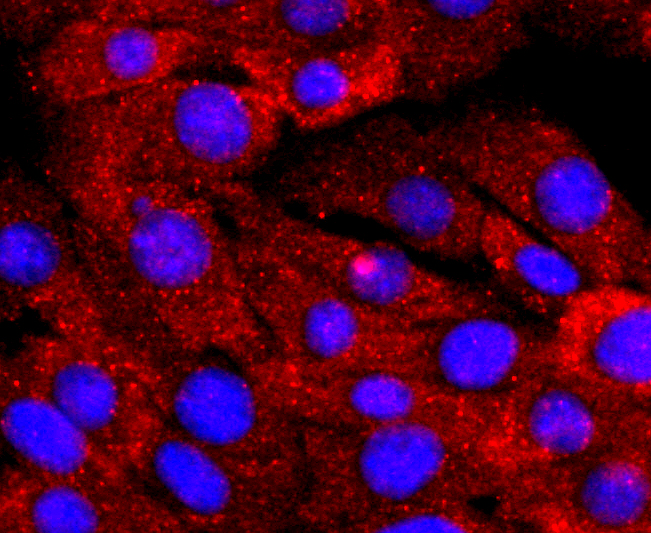 NGAL Antibody