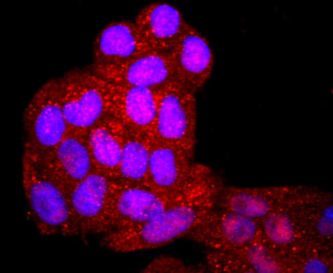 KIM1 Antibody