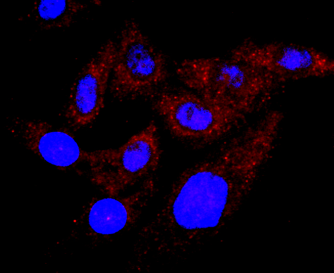 TSH Antibody