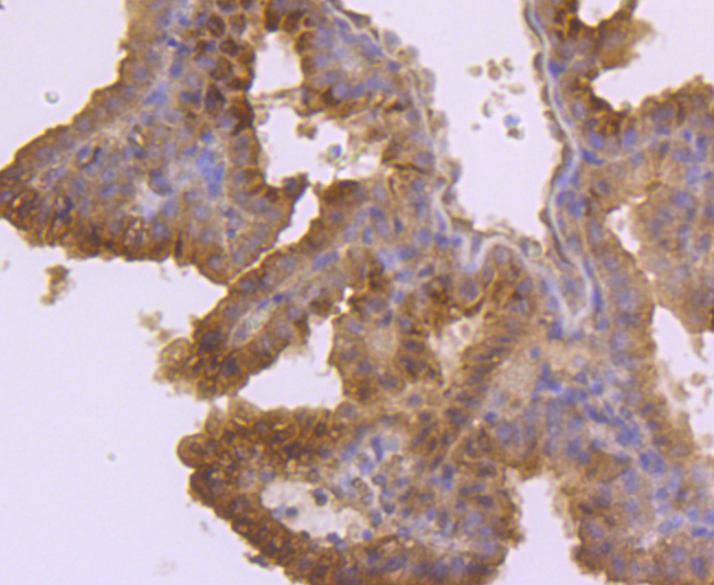 TSH Antibody