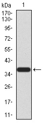 PRDM5 Antibody