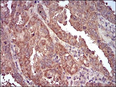 CAV2 Antibody