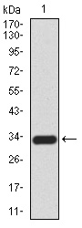 CK5 Antibody