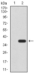 CK5 Antibody