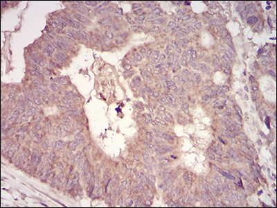 MuRF1 Antibody