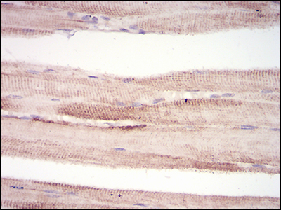 MuRF1 Antibody