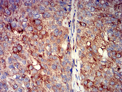 CHRNA7 Antibody