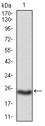 PKHD1 Antibody