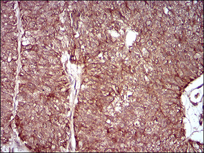 MMEL1 Antibody