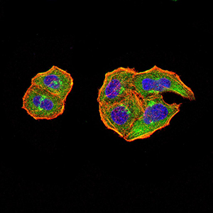 PTPN14 Antibody