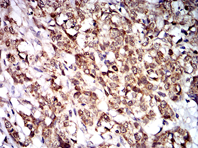 PTPN14 Antibody