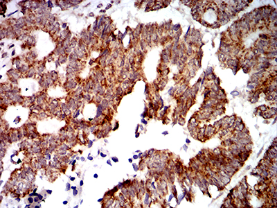 PTPN14 Antibody