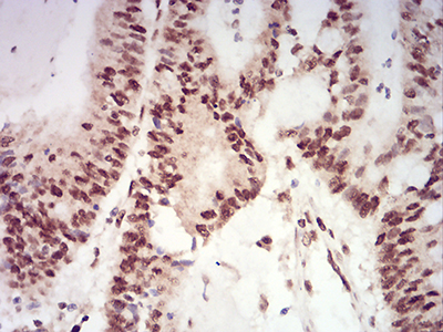 XRN2 Antibody