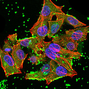 JARID2 Antibody