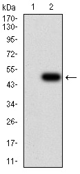 JARID2 Antibody