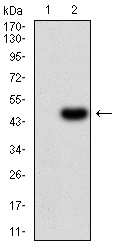 IL1RAPL1 Antibody